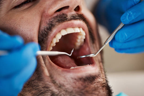 Best Dentist for Severe Toothache  in Fort Hood, TX